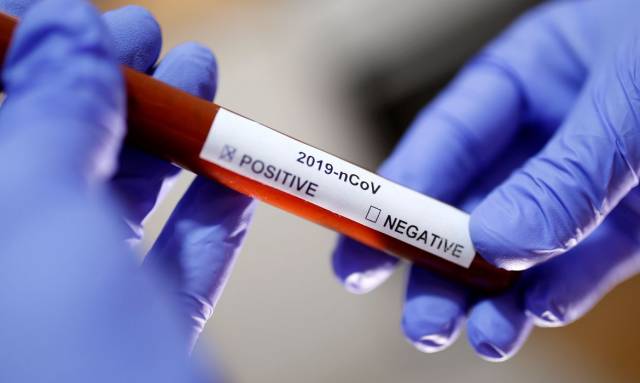 Três de Maio registra 22 novos casos de coronavírus