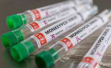 Varíola dos macacos: calendário de vacinação deve sair nesta semana